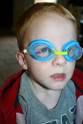 Goggles