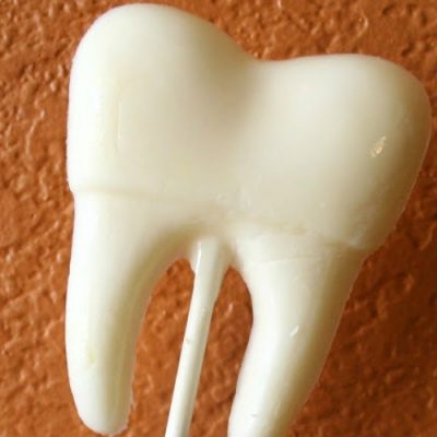 Lost Tooth Idea